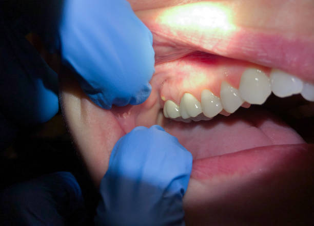 Best 24-Hour Emergency Dentist  in Pontotoc, MS